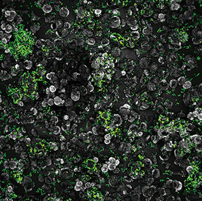 Here we see the relationship between biofilm and hard water deposits (the white crystals). This demonstrates how a biofilm matrix may contain inorganic substances as well.