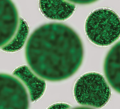 The single cells of cyanobacteria (in this case, green algae) under a microscope.