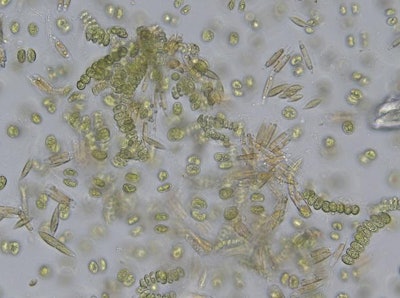 Mixed population of green and diatom algae from swimming pool water samples.